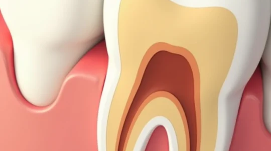 home-remedies-to-soothe-wisdom-tooth-pain